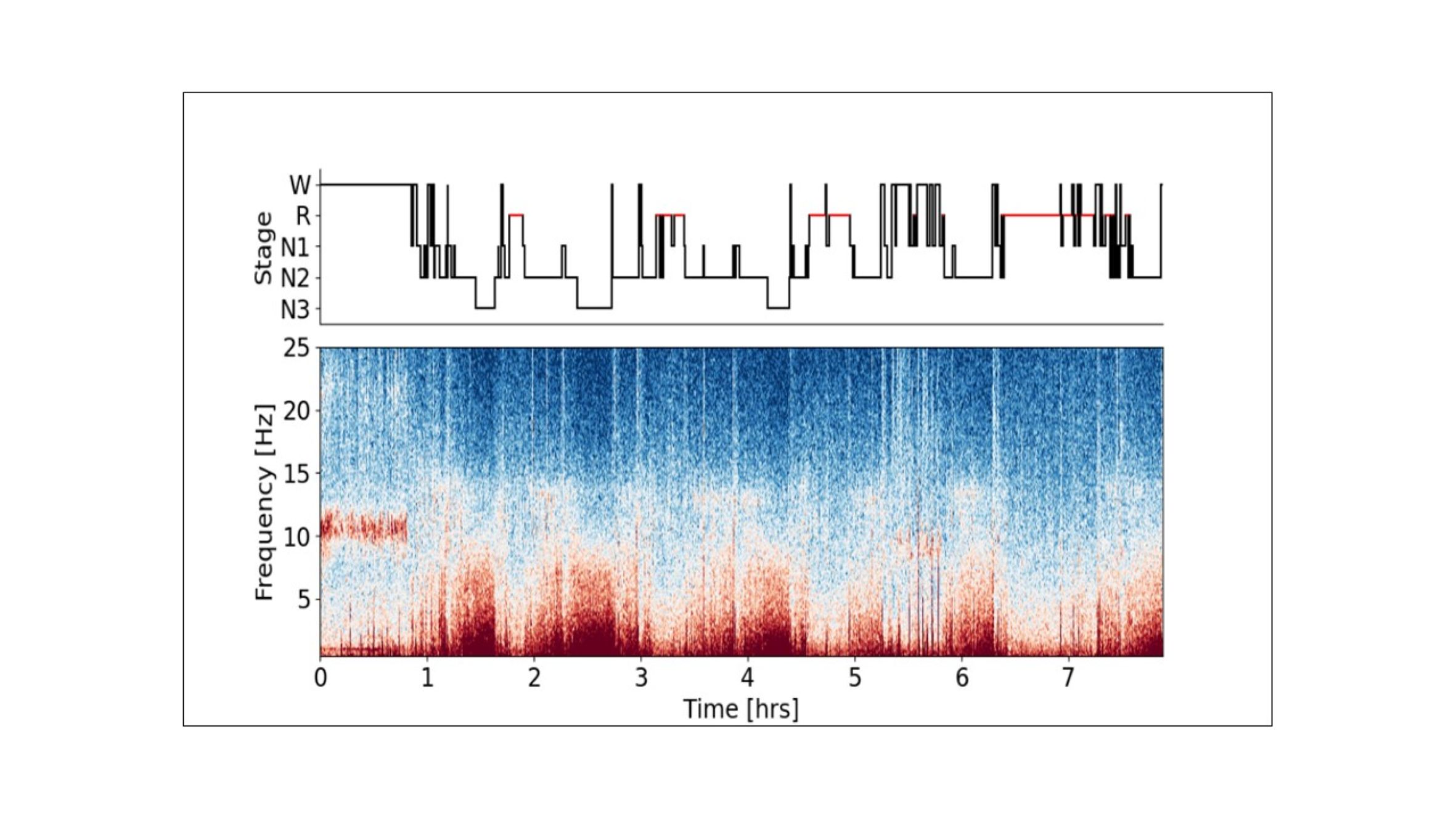 Sleep Stage Visualization